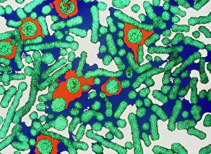 Images Dated 29th November 2004: Hepatitis B viruses