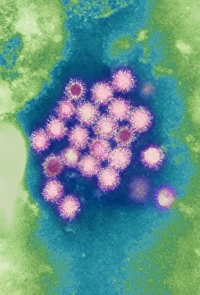 Coloured TEM Images Prints: Hepatitis B viruses