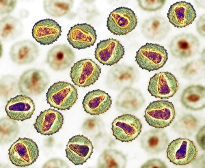 TEM HIV particles Print, coloured transmission electron micrograph