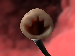 Medical Illustration Art Prints: Hookworm head, artwork