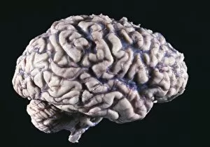 Images Dated 10th March 2003: Human brain