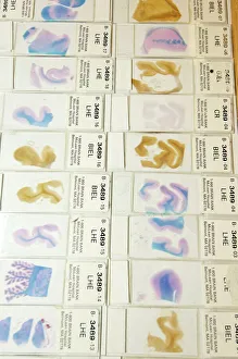 Images Dated 2006: Human Brain Microscope Slide Print