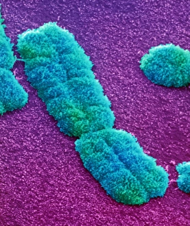 Prints of Human chromosome. Coloured scanning electron micrograph (SEM) of a human chromosome Images Dated 2001 March: Human Chromosome Print (SEM)