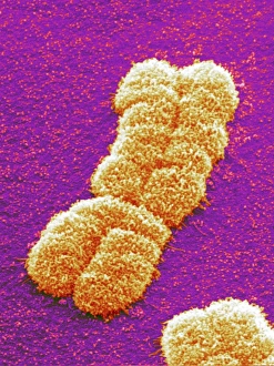 Images Dated 25th June 2004: SEM Human Chromosome Pair Print