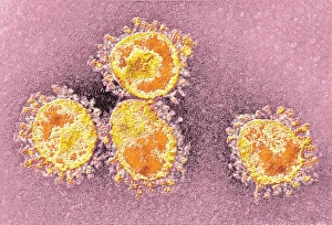 Coloured Transmission Electron Micrograph Prints: Human coronavirus, TEM