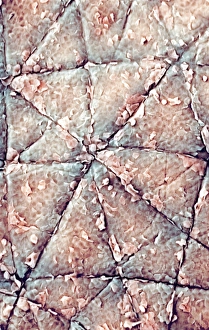 Human Skin SEM Prints: Human skin surface, SEM