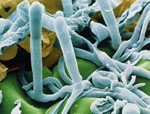 Hyphae and asci of Sphaerotheca mildew Hyphae and asci of Sphaerotheca mildew