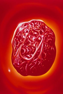 Illustration of blood cells & fibrin in a thrombus Illustration of blood cells & fibrin in a thrombus