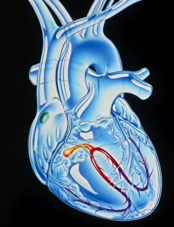 Illustration of electrical conduction in the heart Illustration of electrical conduction in the heart