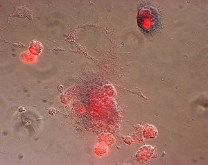 Immune response Immune response