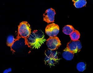 Immunofluorescent LM of natural killer blood cells Immunofluorescent LM of natural killer blood cells