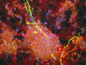 Immunofluorescent LM of rat brain cells and axons Immunofluorescent LM of rat brain cells and axons