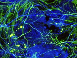 Induced Nerve Stem Cells Print