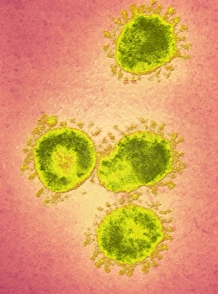 Infectious Bronchitis Virus Print, TEM Image
