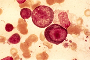 Images Dated 22nd February 2013: Infectious Mononucleosis Print, Light Micrograph of Blood Cells