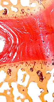 Light Micrograph Prints: Intervertebral disc, light micrograph