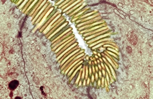 TEM Print of Intestinal Microvilli Structure