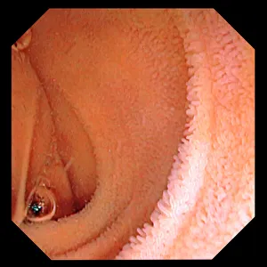Images Dated 2012 April: Intestinal lining Print