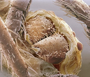 Scanning Electron Micrograph Prints: Jumping spider jaws, SEM