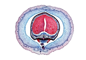 Light Microscopy Images Prints: Kidney bean, light micrograph