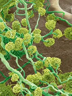 Scanning Electron Microscope Images Prints: Kidney glomeruli, SEM