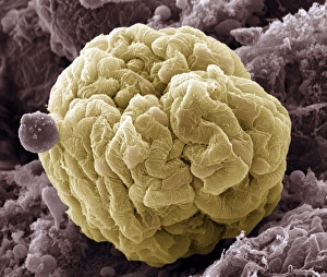 Kidney Glomerulus Print, SEM Colour Micrograph