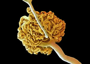 Coloured SEM Print of a Kidney Glomerulus