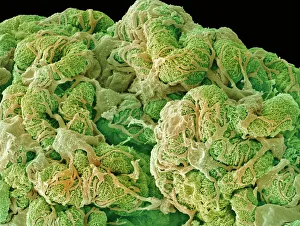 Prints of Kidney glomerulus. Coloured scanning electron micrograph (SEM) of tissue from a healthy kidney, showing the glomerular structure. The surface of a glomerulus is encased in podocyte cells Images Dated 2006 October: SEM Print of Kidney Glomerulus