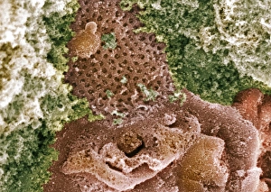 Prints of Kidney glomerulus surface. Coloured scanning electron micrograph (SEM) of podocyte cells (orange) on the surface of a kidney glomerulus. These have branching processes (pedicles) that interlock Images Dated 2009 March: Kidney glomerulus surface, SEM Print