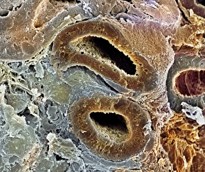 Kidney tubules Kidney tubules
