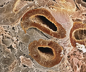 Kidney tubules, SEM Kidney tubules, SEM
