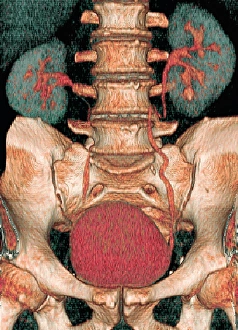 Kidney Anatomy Prints: Kidneys and bladder, 3D CT scan