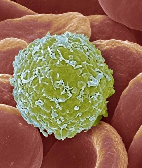 Images Dated 7th March 2013: SEM Print of Leukaemia Cell