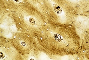 Prints of Light micrograph of a cross-section of normal human compact bone tissue, as found in the shafts of the long bones such as the femur Images Dated 2003 October: Light Micrograph Print of Human Compact Bone Tissue