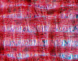 Light Microscopy Images Prints: Light micrograph of polyamide in tissue