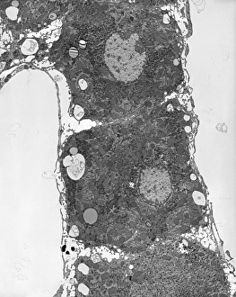 Images Dated 14th February 2013: TEM Liver Tissue Print