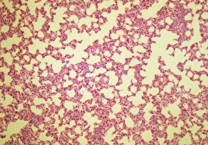 LM of a cross section through alveoli in the lung LM of a cross section through alveoli in the lung
