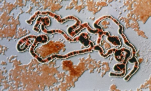 LM of Drosophila giant (polytene) chromosome LM of Drosophila giant (polytene) chromosome