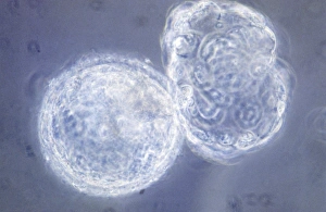 LM of hatching blastocyst in IVF LM of hatching blastocyst in IVF