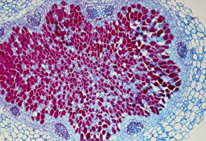 LM of a root nodule LM of a root nodule