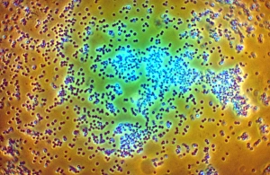 Gram Positive Bacteria Prints: LM of staphylococcus aureus