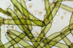 LM of Vorticella ciliates on a green alga LM of Vorticella ciliates on a green alga