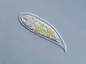 Light Microscopy Images Prints: Loxophyllum ciliate, light micrograph