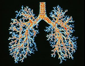 Prints of Lung airways. Computer-enhanced image of a resin cast of the airways in the lungs. The trachea (windpipe, top centre) divides into two main bronchi Images Dated 2003 February: Computer-enhanced resin cast print of the human lung airways