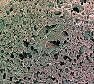 Images Dated 3rd March 2003: Lung alveoli, SEM