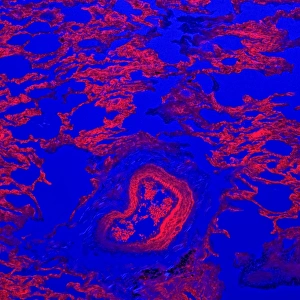 Confocal Microscopy Images Prints: Lung tissue, confocal micrograph C014 / 4616