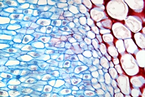 Prints of Lupin root nodules. Light micrograph of a section through the root nodule of a lupin (Lupinus lupin) plant. The plants root nodules are full of nitrogen-fixing Rhizobium sp Images Dated 2012 January: Lupin root nodule print