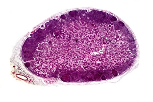 Lymph Gland Print, Light Micrograph
