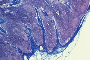 White Blood Cell Types Prints: Lymph node, light micrograph C015 / 6223