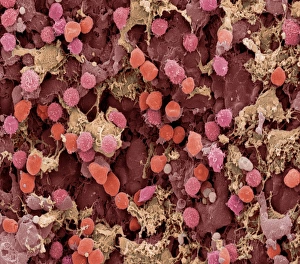 Images Dated 27th January 2003: Lymph Node Print, SEM